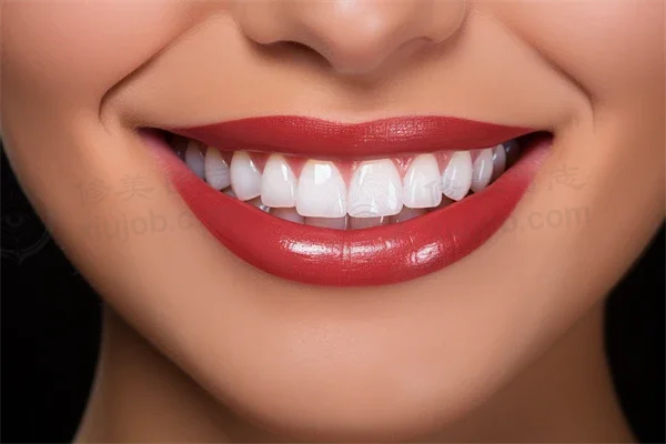 机会难得！超值服务体验，活动义齿现仅需2500元起，原价3000元起，欢迎光临北京靓美口腔医院！