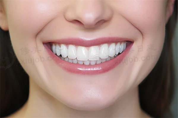 苏州牙科医院排名前十，哪家更值得信赖？苏州康洁口腔门诊部洗牙项目品质杰出，服务贴心！