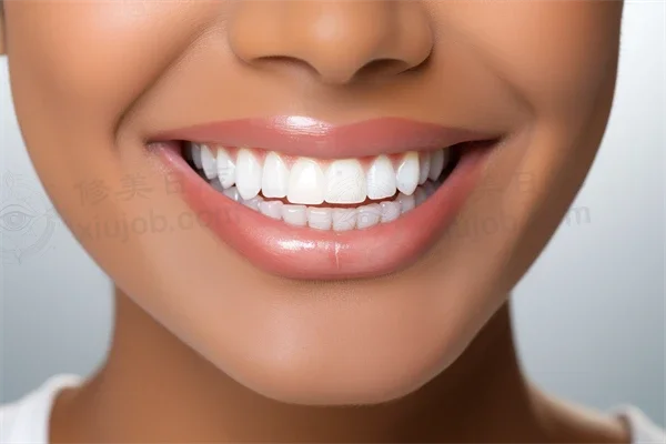 中山地区牙科医院排名前十，哪家更优质？中山好民生口腔门诊部烤瓷牙项目值得信赖！