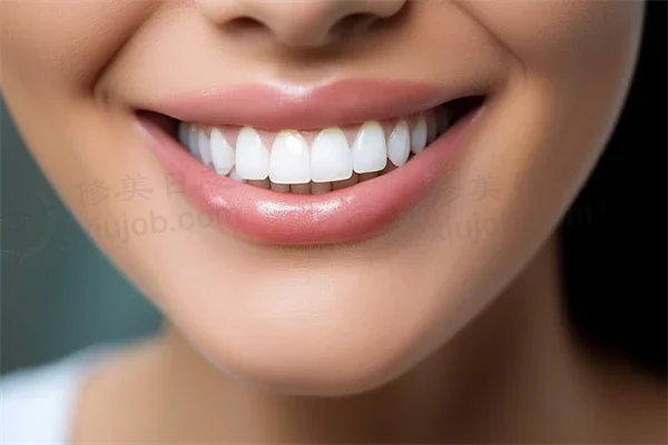 深圳牙科医院排名前十：哪家更具实力？深圳登缇丝口腔医院全瓷牙项目值得信赖，结果显著！