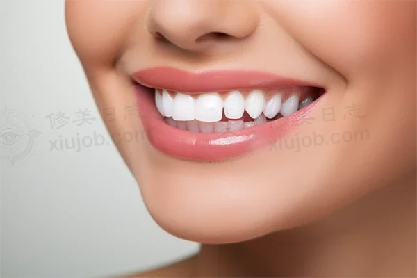 汕头市牙博士口腔门诊洗牙价格表更新：原价388元起，现仅需199元起，尽享超值洗牙服务！