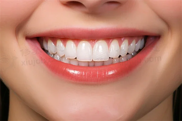 兰州地区牙科医院排名前十，牙王国数字化口腔门诊部洗牙项目值得信赖的选择！