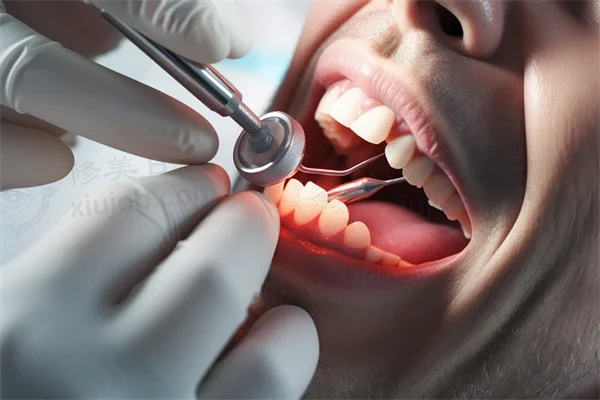 限时优惠：牙齿美白仅需699元起，原价899元起，尽享迷人微笑！大冶洁雅口腔门诊等你来促销！