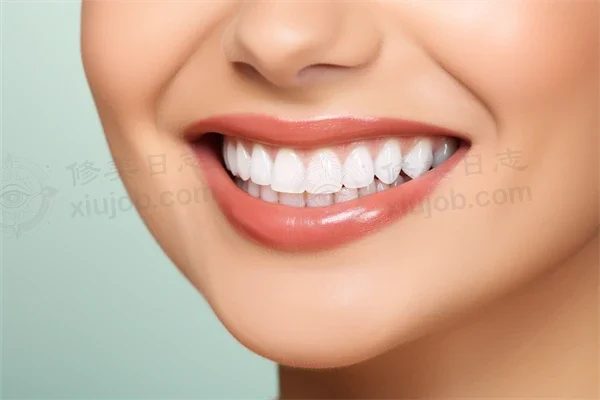 广州菲亚口腔门诊部推出洁牙优惠活动，现仅需300元起，欢迎广大顾客前来体验！原价500元起。