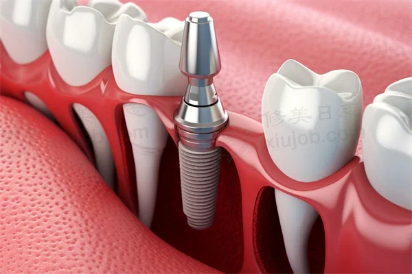 深圳美澳口腔医院客服电话是多少？2026年最新咨询电话及服务信息一览