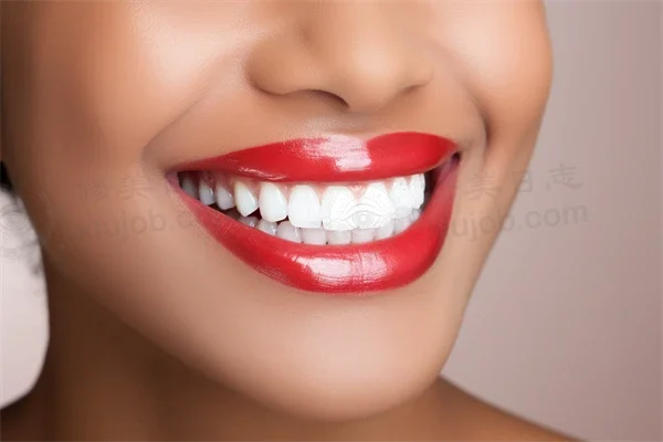 台州排名前十的牙科医院推荐，康贝佳口腔医院补牙项目结果显著，值得信赖的选择！