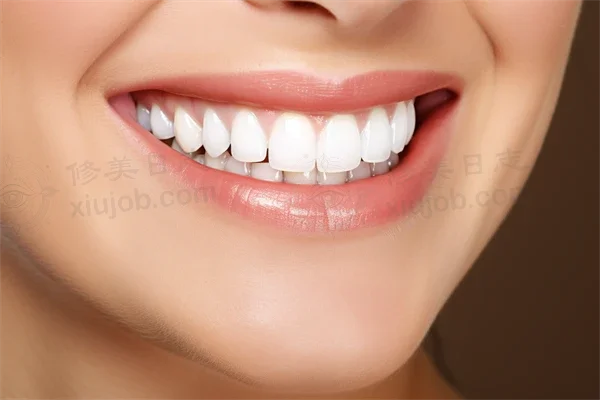 惠州牙科医院排名前十，爱雅仕口腔门诊部补牙项目值得信赖，专業可靠的选择