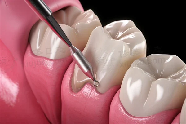 荣成一诺口腔门诊部拔牙价目表：原价800元起，现仅需600元起，助您轻松解决口腔问题，优惠活动确实值得把握！