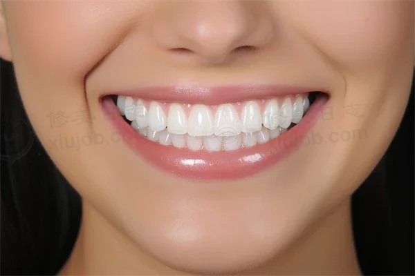 杭州佳尔仕口腔（水云和达城门诊）种植牙收费现仅需6000元起，原价8000元起，限时优惠，抓紧机会！