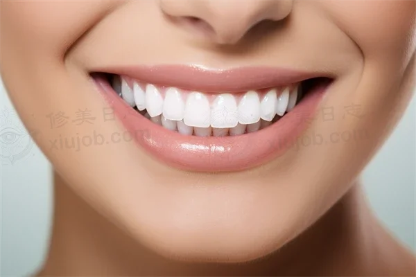 杭州市瑞创口腔门诊部(总部旗舰店)牙套费用现仅需4000元起，原价5000元起，助您轻松拥有自信的微笑！