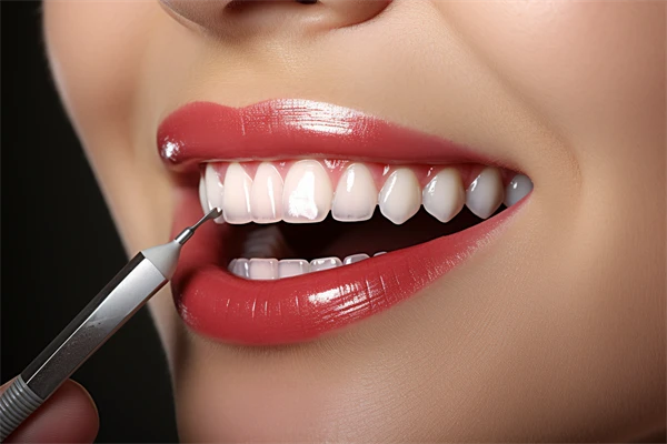 杭州洁雅口腔门诊部牙周治疗现优惠，仅需680元起！原价800元起，限时优惠，抓紧时间预约，体验专業护理！