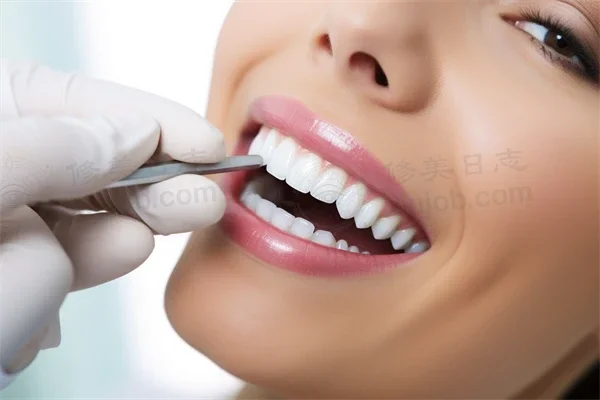 惠州地区牙科医院排名前十，爱雅仕口腔门诊部牙齿矫正项目结果显著，值得信赖的选择