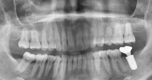 实力雄厚的医生团队