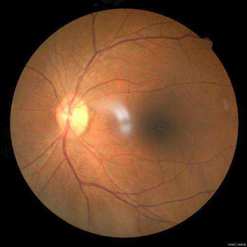 建德市第一人民医院眼科