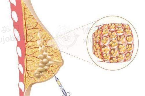 四、郑州铭艺医疗美容开展的项目以及特色项目