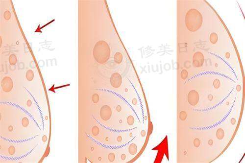 七、郑州铭艺医疗美容价格表：（仅供参考）