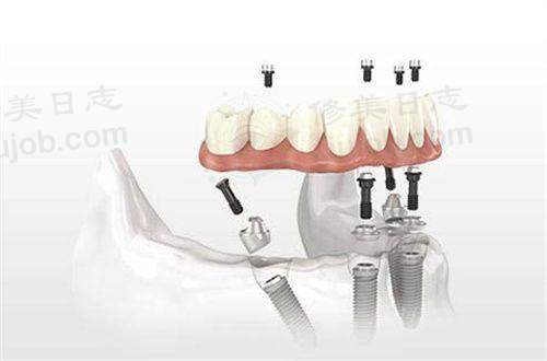 三、银川市名仁口腔门诊部医生介绍: