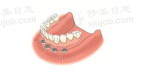 七、李龙雨医生近期真实评价