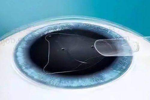 宁波爱尔光明眼科(江北诊所)宁波爱尔光明眼科（江北诊所）地址电话营业时间