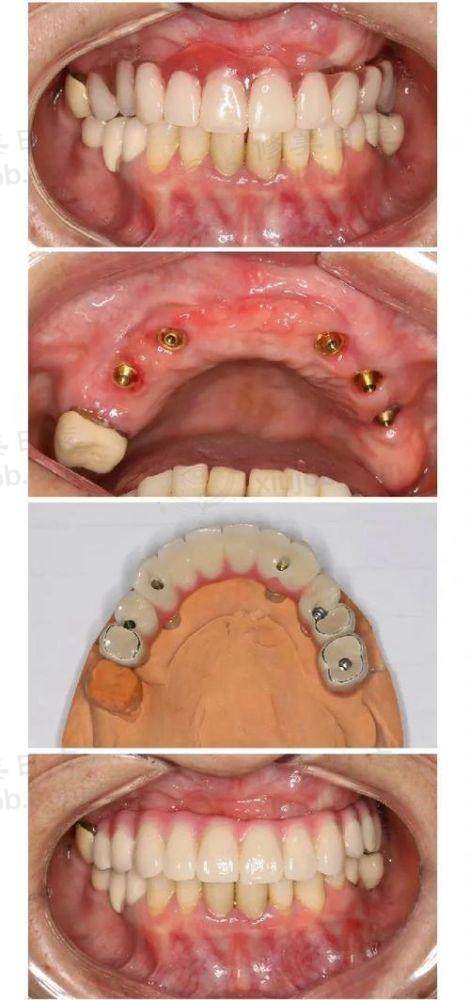 蜀山区安徽天鹅湖口腔医院和金科口腔门诊部哪个好？从多方面对比分析