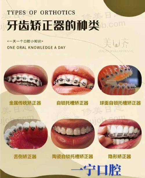 七、银川市名仁口腔门诊部价格表：（仅供参考）