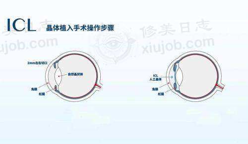 宁波爱尔光明眼科(江北诊所)