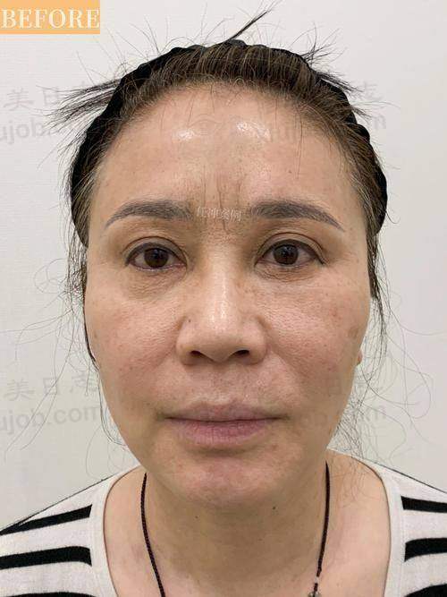 常见问题解答（FAQ）