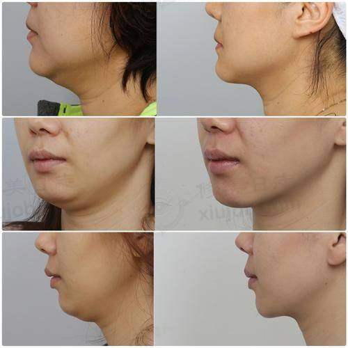 收费与价格原则说明