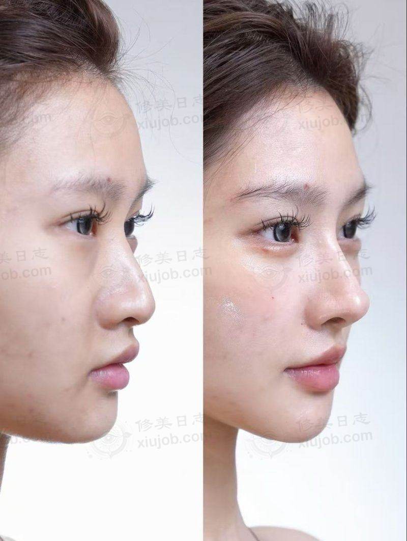 八、郑州铭艺医疗美容用户真实实例