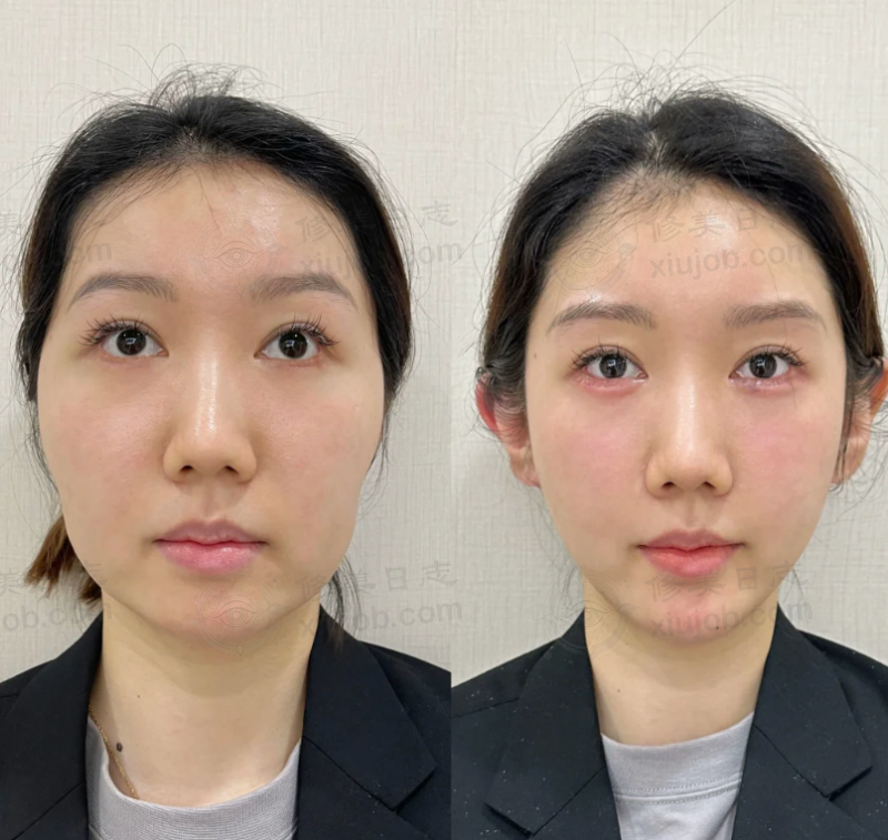 六、郑州铭艺医疗美容怎么预约：