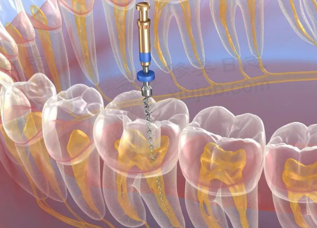 四、银川市名仁口腔门诊部开展的项目以及特色项目