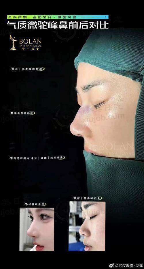 北京联帮医疗美容诊所李秉跃医生手术费用是多少？价格透明很合理