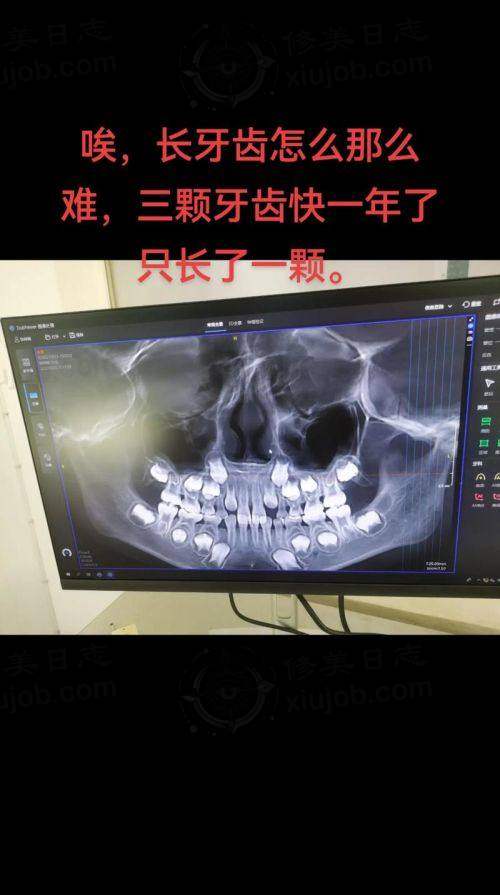 优惠活动详情