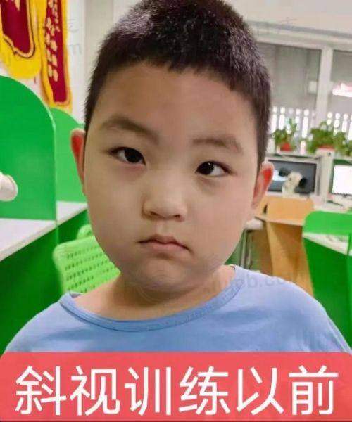 临床实例分享