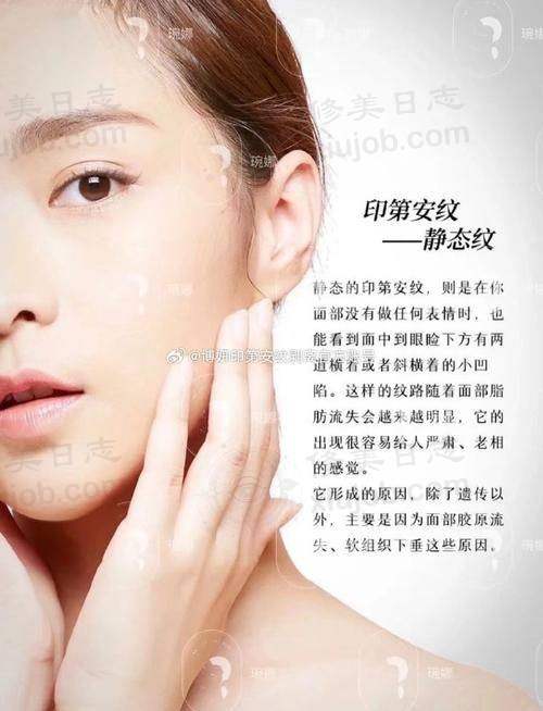 优惠活动详情