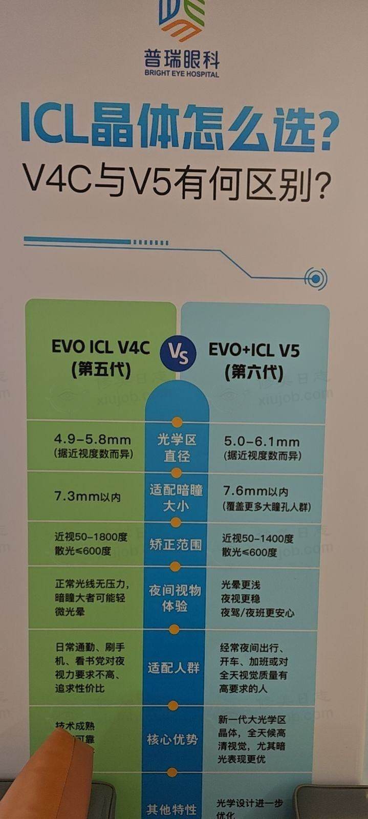 我在西安普瑞做ICL晶体植入手术，第二天视力就达1.0啦！ 