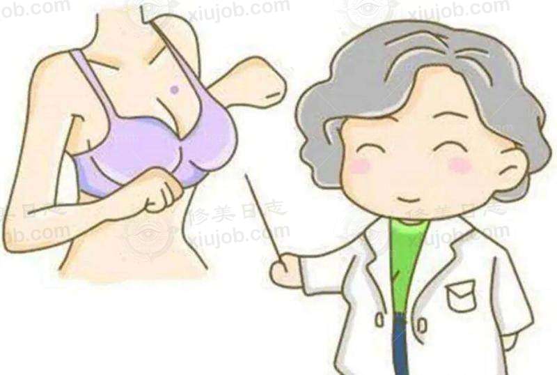 广州中家医家庭医生门诊部双侧乳晕缩小仅6800元，黄广香医生亲诊！