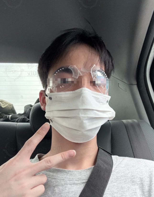 我多年近视难题，在东莞爱尔眼科术后一周双眼恢复 1.2 解决啦！ 